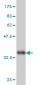 ADPGK Antibody (monoclonal) (M01)